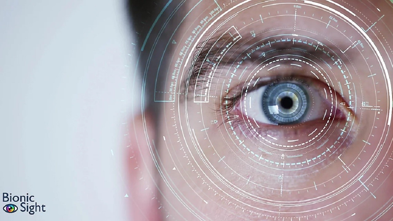 Bionic Sight начала 1 этап клинического исследования нового метода лечения потери зрения