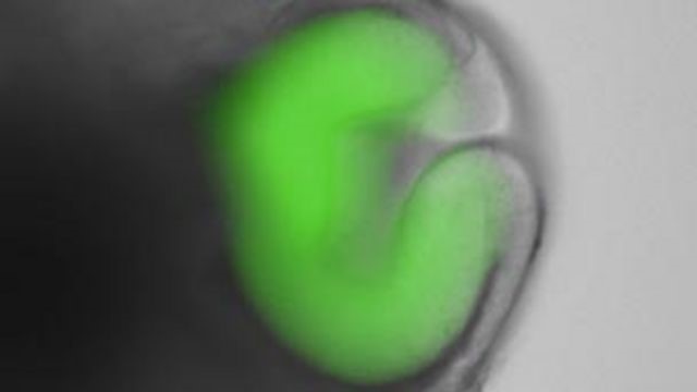 Ученые используют кожу пациентов с пигментным ретинитом для создания клеток сетчатки с целью определения источников заболевания